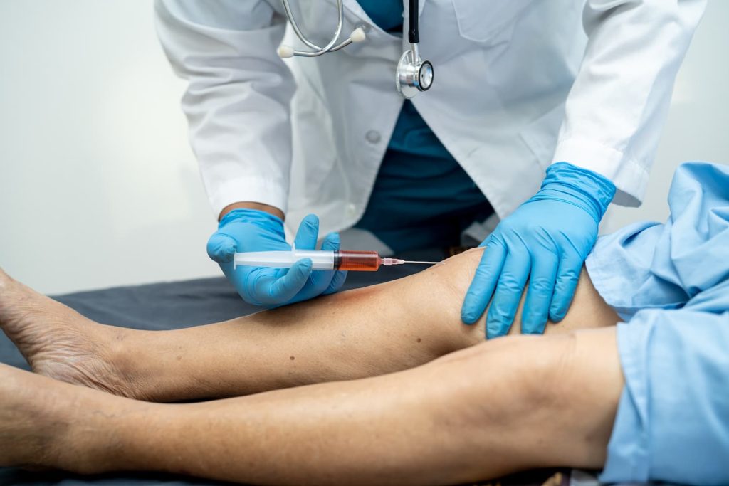 PRP injections in Miami, FL